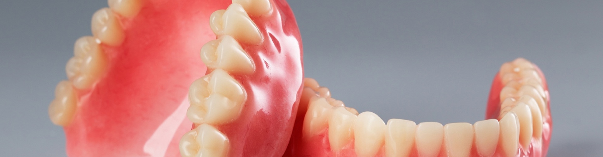 Lower and upper implant-retained dentures leaning on each other.